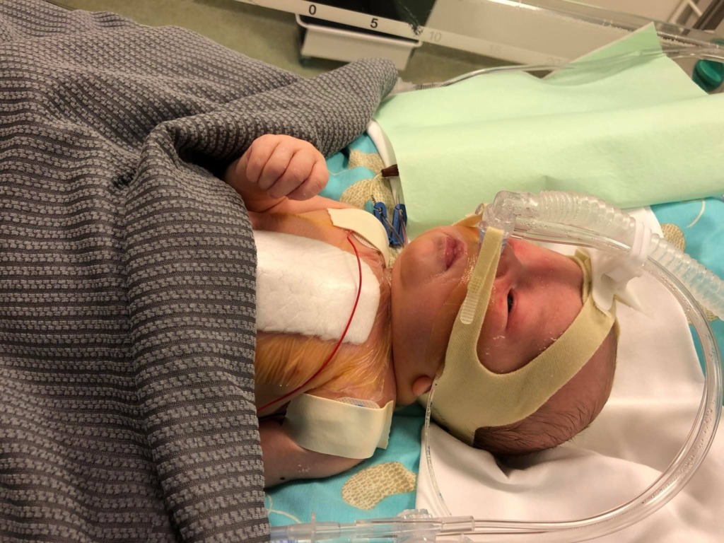 PALUN AITAME KOOS I Südamerikkega sündinud pisikese Georgi elu päästaks südameoperatsioon, mida tehakse Helsingi lastehaiglas